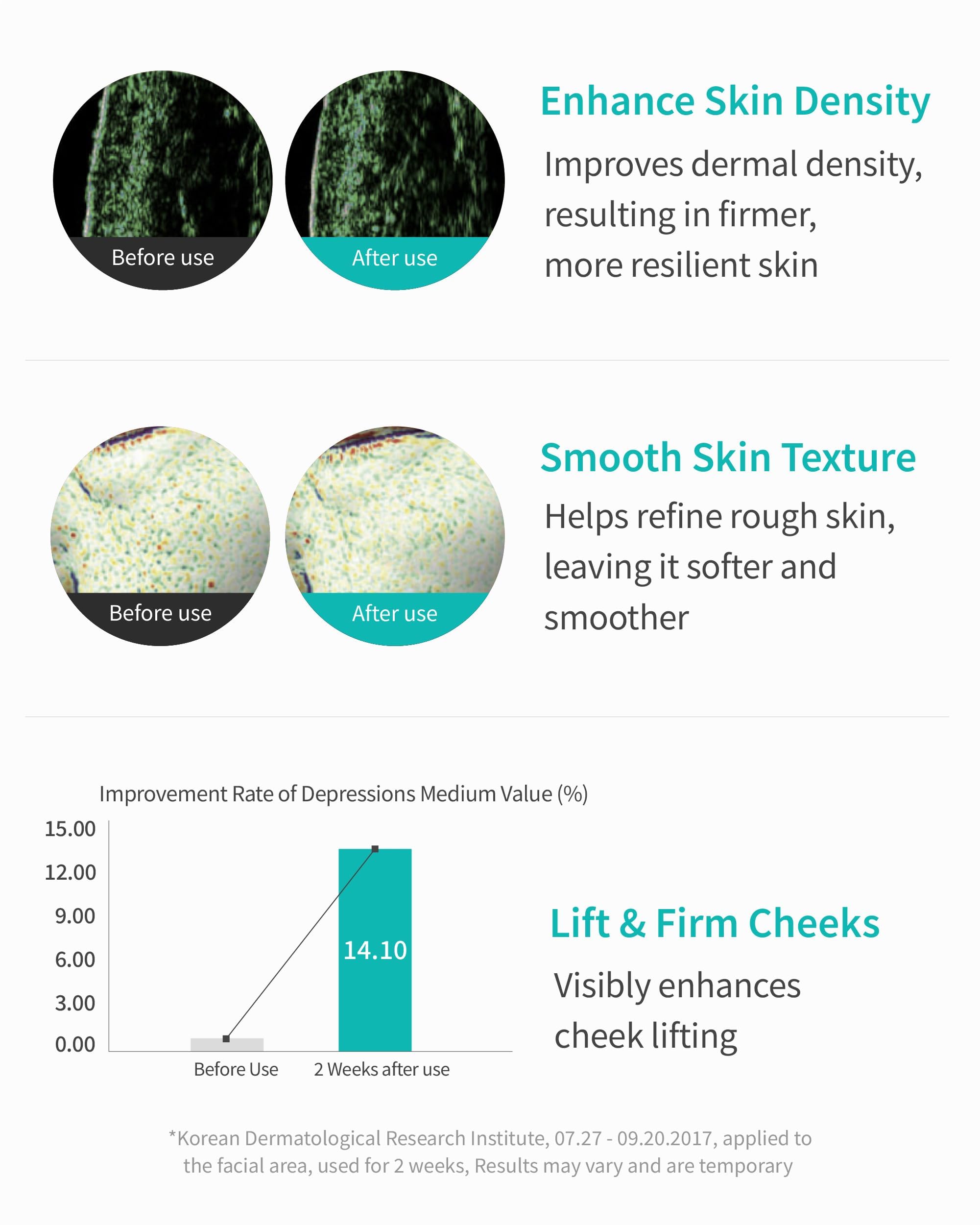 REJURAN® Turnover Ampoule, c-PDRN® – Original Salmon DNA PDRN Face Serum for Firming, Hydrating, Radiant Glass Skin with Visible Anti-Aging Results. Korean Skin Care, Clinically Developed (1.01 fl oz)