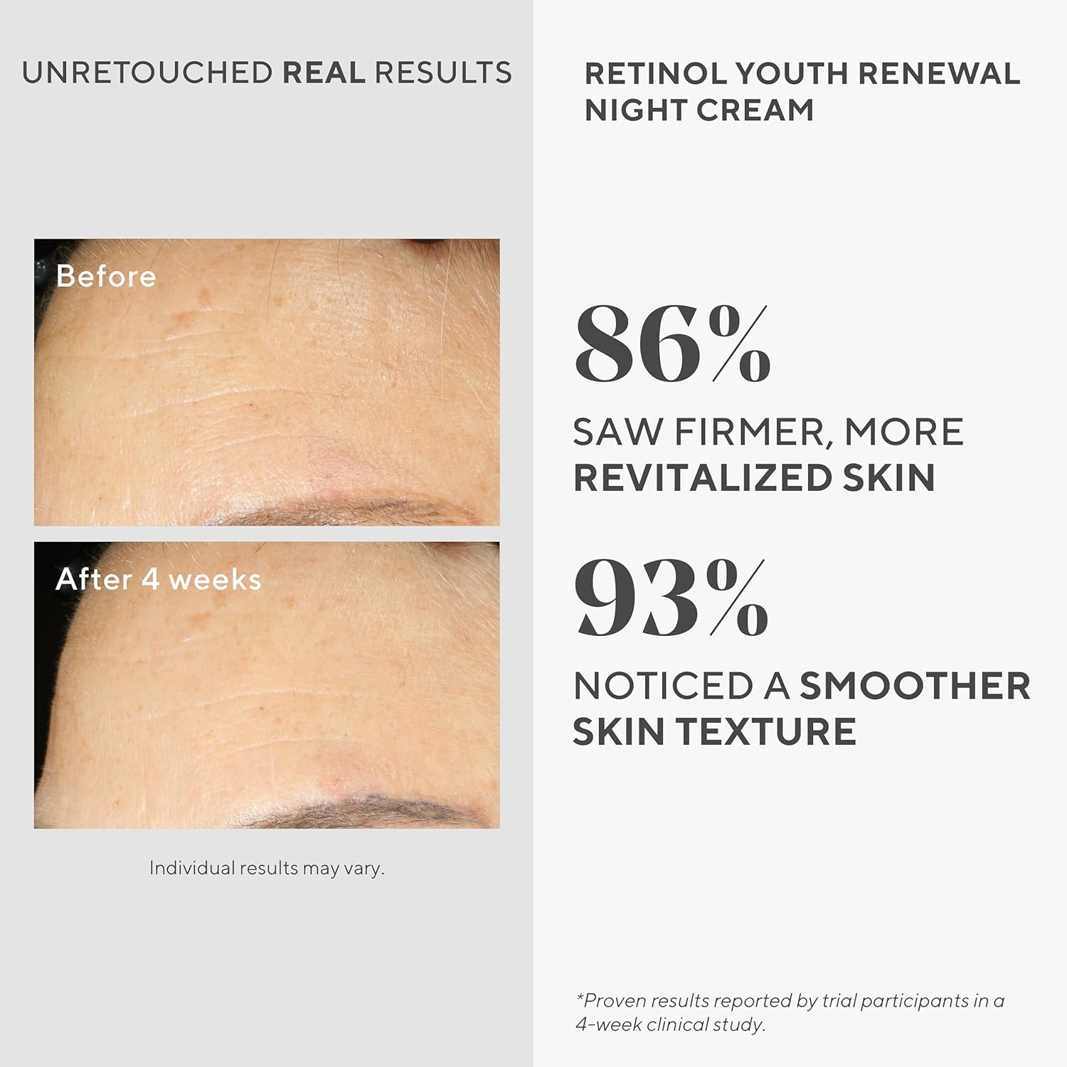 Murad Retinol Youth Renewal Night Cream - Anti-Aging Moisturizer with Retinol Tri-Active Technology and Niacinamide Gently Fights Wrinkles and Fine Lines, Boosts Radiance and Firms Skin - 1.7 Fl Oz